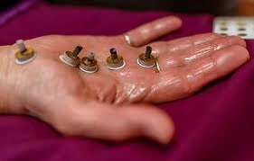 Korean Hand Therapy session